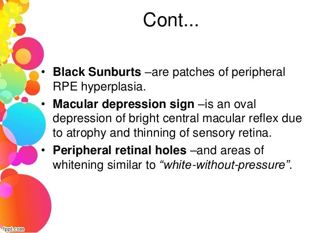scleral icterus and sickle cell anemia scleral icterus and sickle cell anemia