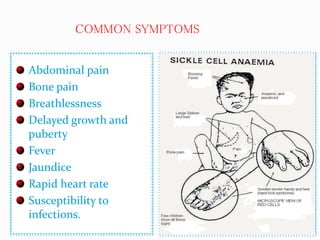 Abdominal pain
Bone pain
Breathlessness
Delayed growth and
puberty
Fever
Jaundice
Rapid heart rate
Susceptibility to
infections.
COMMON SYMPTOMS
 