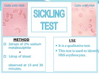 Cells with HbS Cells with HbA
METHOD
 2drops of 2% sodium
metabisulphite
+
 1drop of blood
observed at 15 and 30
minutes.
USE
 It is a qualitative test.
 This test is used to identify
HbS erythrocytes.
 