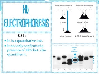 Sickle
cell
anemia
normal Sickle cell
trait
A
F
S
C
USE:
 It is a quantitative test.
 It not only confirms the
presence of HbS but also
quantifies it.
 