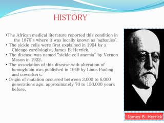 James B. Herrick
HISTORY
•The African medical literature reported this condition in
the 1870’s where it was locally known as ‘ogbanjes’.
• The sickle cells were first explained in 1904 by a
Chicago cardiologist, James B. Herrick.
• The disease was named “sickle cell anemia” by Vernon
Mason in 1922.
• The association of this disease with alteration of
hemoglobin was published in 1949 by Linus Pauling
and coworkers.
• Origin of mutation occurred between 3,000 to 6,000
generations ago, approximately 70 to 150,000 years
before.
 