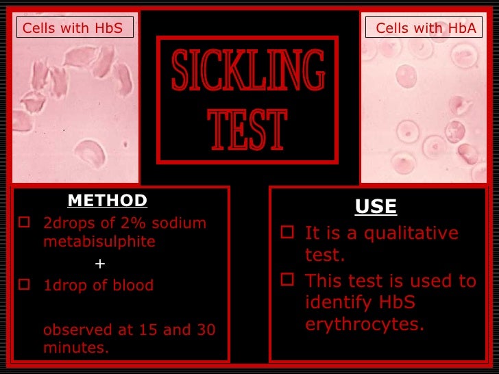 Sickle Cell Anemia