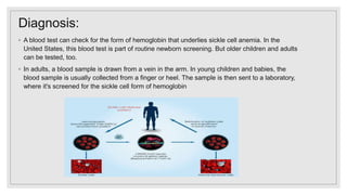 Diagnosis:
◦ A blood test can check for the form of hemoglobin that underlies sickle cell anemia. In the
United States, this blood test is part of routine newborn screening. But older children and adults
can be tested, too.
◦ In adults, a blood sample is drawn from a vein in the arm. In young children and babies, the
blood sample is usually collected from a finger or heel. The sample is then sent to a laboratory,
where it's screened for the sickle cell form of hemoglobin
 