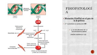  Mutación Glu6Val en el gen de
la β-globina
 17° nucleótido se cambia de AT
 ↓ LA SOLUBILIDAD DE LA
DESOXIHEMOGLOBINA
UNIÓN CADENA β1 Y β2
 