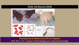 Sickle-cell diseases (SCD)
Developed by-Dr.Abdulrazzaq Othman Alagbare
M.D M.S.c C.P - Lecturer of Hematology and Immunohematology
 