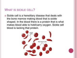 What is sickle cell?Sickle cell is a hereditary disease that deals with the bone marrow making blood that is sickle shaped. In the blood there is a protein that is what makes blood able to hold/carry oxygen. Sickle cell blood is lacking that protein.