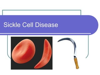 Sickle Cell Disease
 