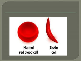 SICKLE CELL PATHOPHYSIOLOGY B.PHARM 2ND SEM.pptx