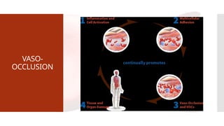 VASO-
OCCLUSION
 