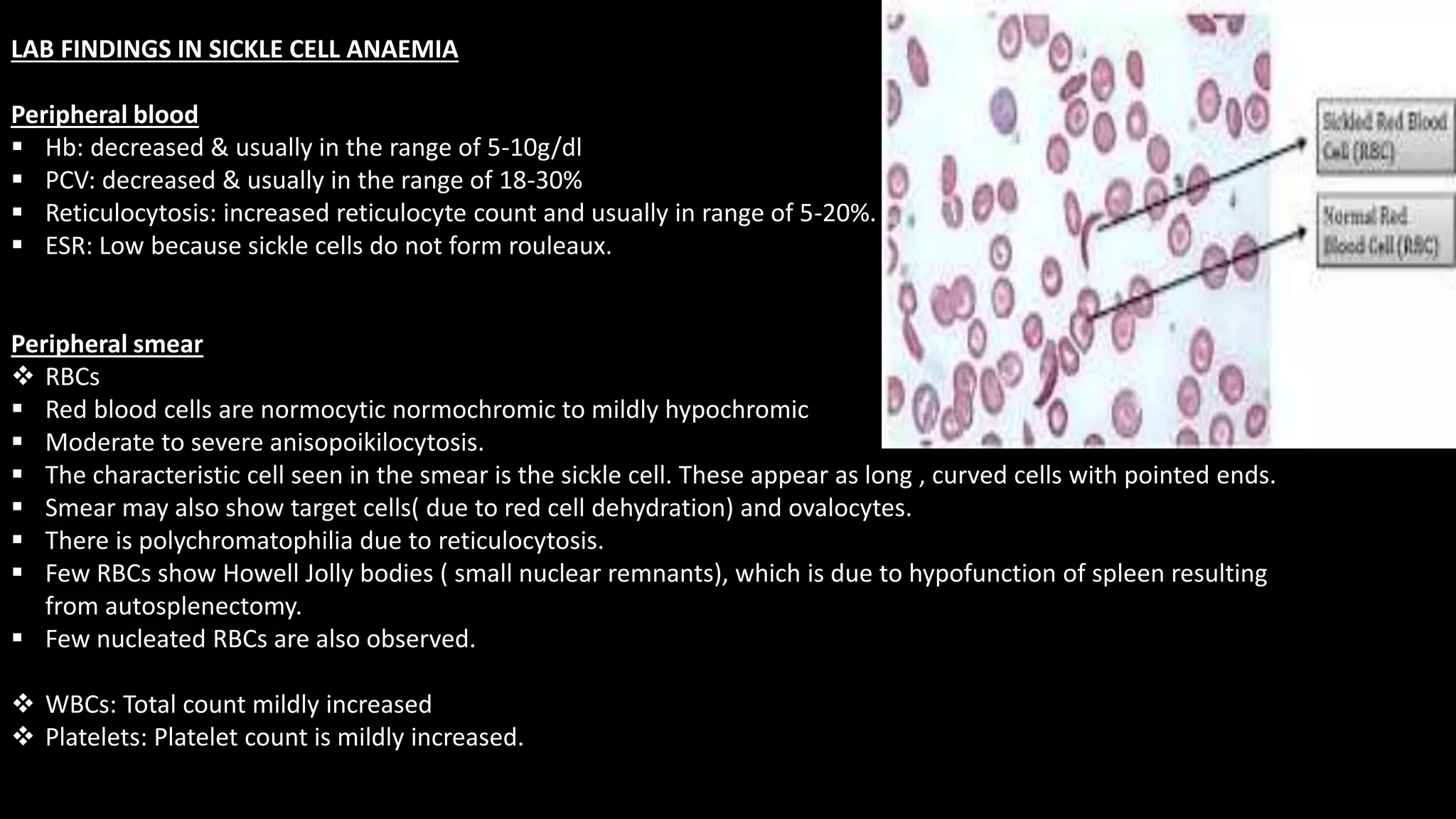 SICKLE CELL ANAEMIA IN PREGNANCY FOR MBBS UNDER GRADUATES OBG | PPTX