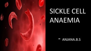 SICKLE CELL
ANAEMIA
- ANJANA.B.S
 