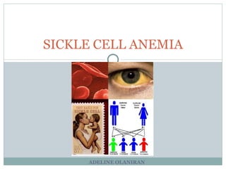 ADELINE OLANIRAN SICKLE CELL ANEMIA 