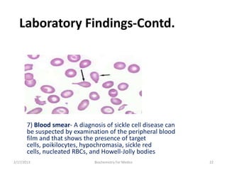 Sickle cell anemia- An Overview | PPTX