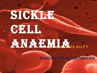 Dr shamsheer ali p t
moDerateD by:Dr.sheena
siCKle
Cell
anaemia
 