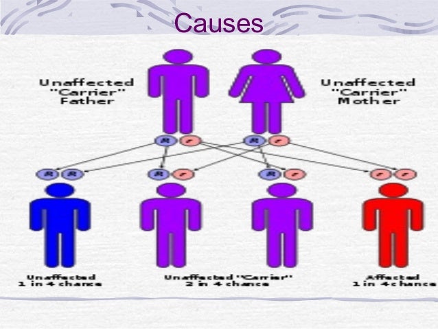 Definition Of Sickle Cell Anemia For Kids Definition Of Sickle Cell Anemia For Kids