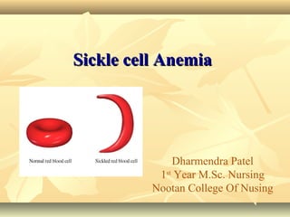 Dharmendra Patel
1st
Year M.Sc. Nursing
Nootan College Of Nusing
Sickle cell AnemiaSickle cell Anemia
 