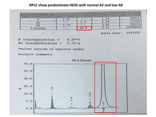 HPLC show predominate HbSS with normal A2 and low A0
 