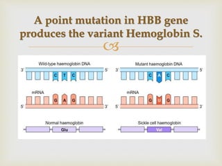 
A point mutation in HBB gene
produces the variant Hemoglobin S.