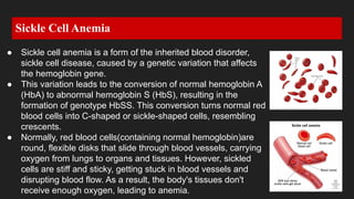 Sickle cell Anemia Diseases . | PDF