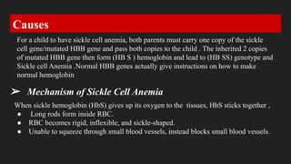 Sickle cell Anemia Diseases . | PDF