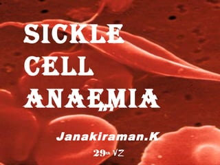 SICKLE
CELL
ANAEMIA
     BY

 Janakiraman.K
      29 VZ
       th
 