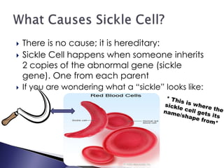  There is no cause; it is hereditary:
 Sickle Cell happens when someone inherits
2 copies of the abnormal gene (sickle
gene). One from each parent
 If you are wondering what a “sickle” looks like:
 