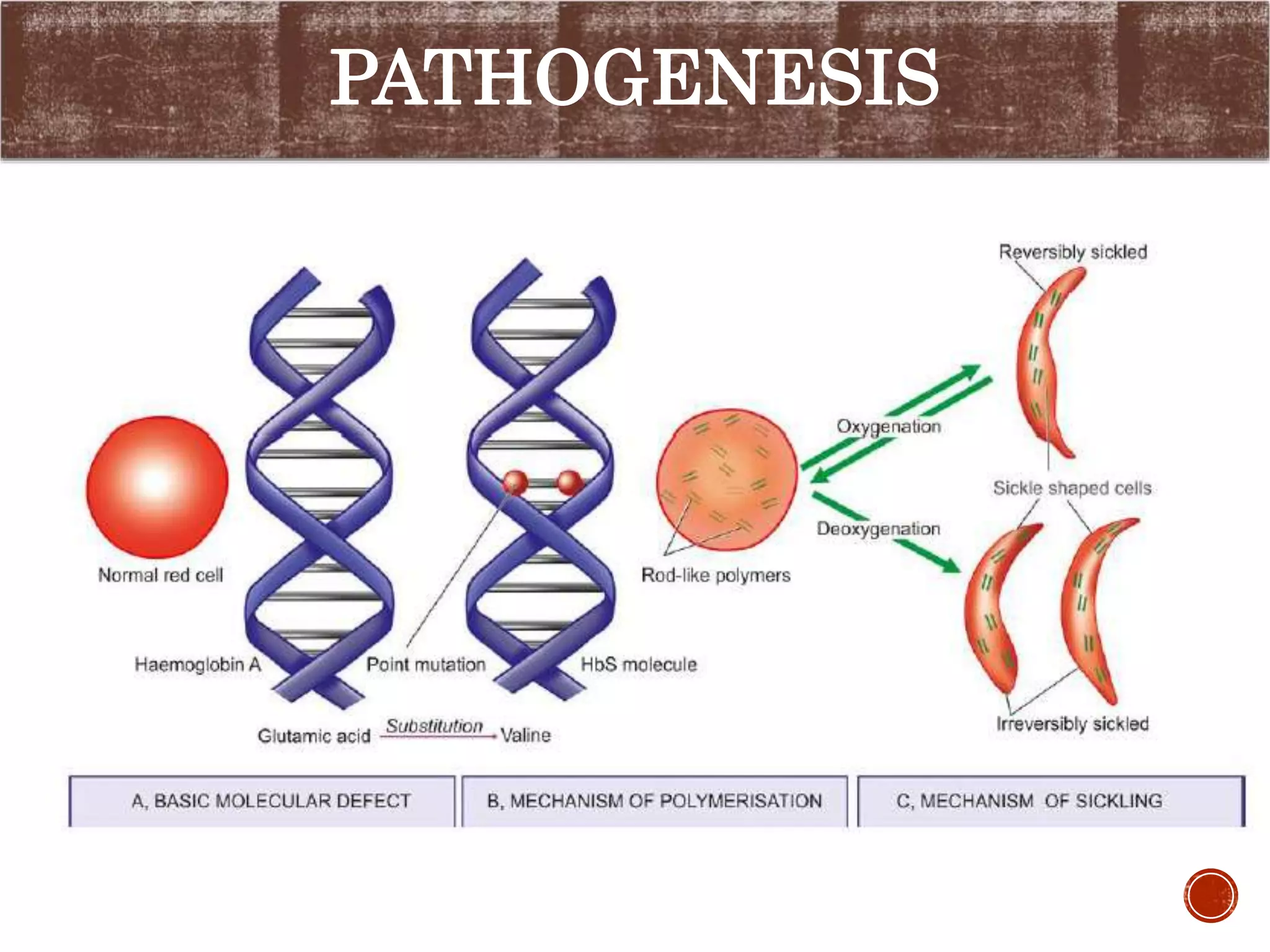 Sickle cell anemia and thalassemia | PPTX