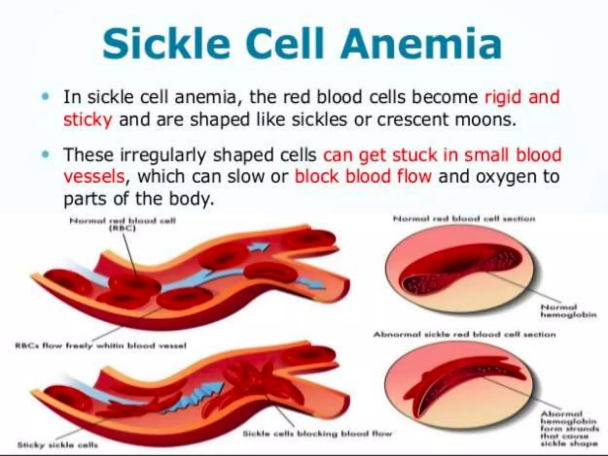 Sickle cell anemia and thalassemia | PPTX