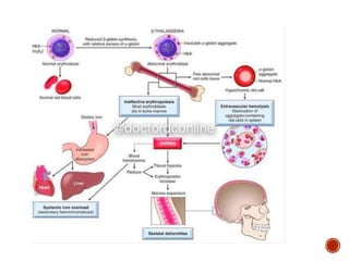Sickle cell anemia and thalassemia | PPTX