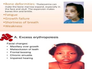 Sickle cell anemia and thalassemia | PPTX