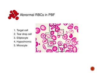 Sickle cell anemia and thalassemia | PPTX