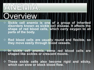 Overview
 Sickle cell anemia is one of a group of inherited
disorders known as sickle cell disease. It affects the
shape of red blood cells, which carry oxygen to all
parts of the body.
 Red blood cells are usually round and flexible, so
they move easily through blood vessels.
 In sickle cell anemia, some red blood cells are
shaped like sickles or crescent moons.
 These sickle cells also become rigid and sticky,
which can slow or block blood flow.
 