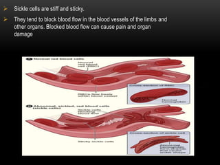  Sickle cells are stiff and sticky.
 They tend to block blood flow in the blood vessels of the limbs and
other organs. Blocked blood flow can cause pain and organ
damage
 