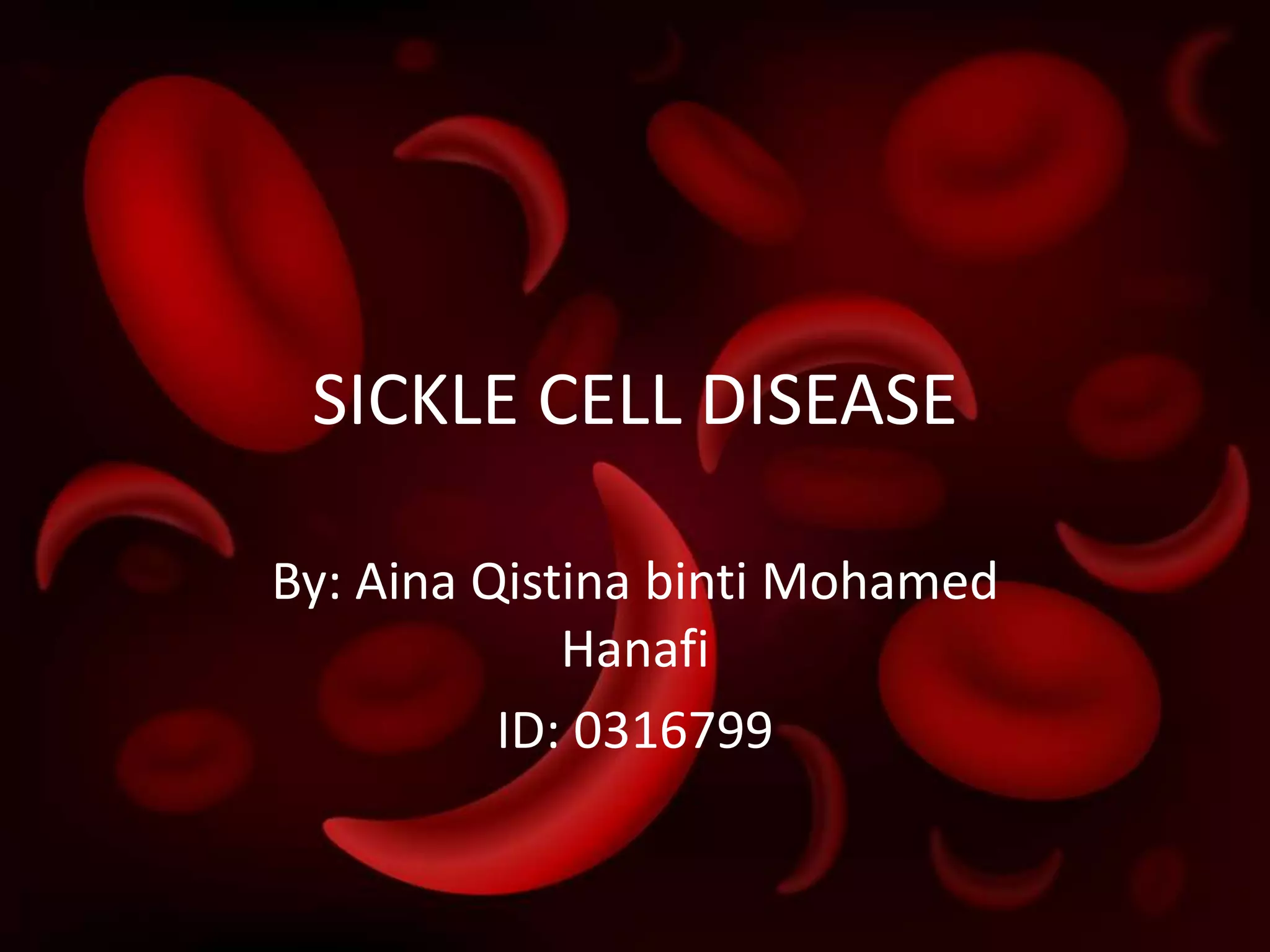 Sickle cell disease PPTX Blood Disorders Diseases and Conditions