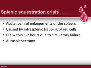 Splenic squestration crisis
• Acute, painful enlargements of the spleen;
• Caused by intrasplenic trapping of red cells
• Die within 1-2 hours due to circulatory failure
• Autosplenectomy
 