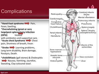 Complications
*Hand-Foot syndrome Pain,
Fever, Swelling.
*Overwhelming (great or very
large)post-splenectomy infection
(OPSI) treated
with antibiotics and supportive care.
*Acute chest Syndrome Chest
pain, Shortness of breath, Fever.
*Stroke Learning problems,
Long term disability, Brain damage,
Paralysis, Death.
*cholelithiasis (gall stones) & Cholecytitis
Nausea, Vomiting, Jaundice,
Sweating, Clay-coloured stool.
 