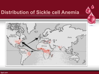 Distribution of Sickle cell Anemia
 