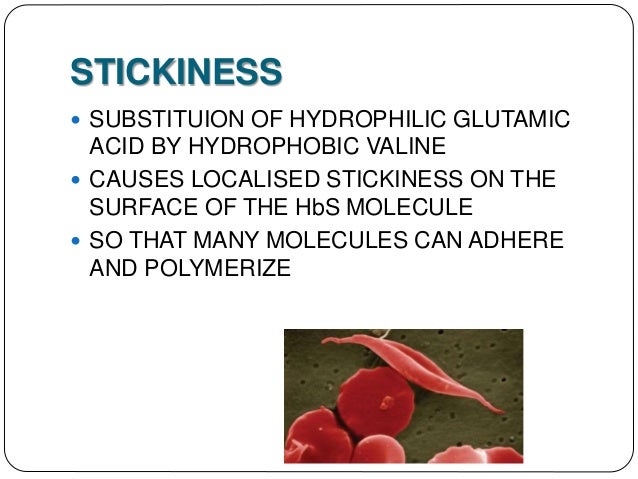 Sickle Cell Disease
