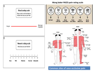 Wong baker FACES pain rating scale
Common sites of vaso-occlusive pain
 