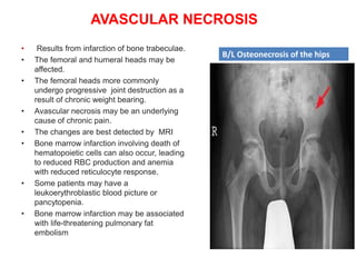 AVASCULAR NECROSIS
• Results from infarction of bone trabeculae.
• The femoral and humeral heads may be
affected.
• The femoral heads more commonly
undergo progressive joint destruction as a
result of chronic weight bearing.
• Avascular necrosis may be an underlying
cause of chronic pain.
• The changes are best detected by MRI
• Bone marrow infarction involving death of
hematopoietic cells can also occur, leading
to reduced RBC production and anemia
with reduced reticulocyte response.
• Some patients may have a
leukoerythroblastic blood picture or
pancytopenia.
• Bone marrow infarction may be associated
with life-threatening pulmonary fat
embolism
B/L Osteonecrosis of the hips
 