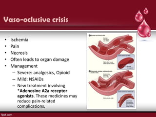 Vaso-oclusive crisis

•   Ischemia
•   Pain
•   Necrosis
•   Often leads to organ damage
•   Management
     – Severe: analgesics, Opioid
     – Mild: NSAIDs
     – New treatment involving
        *Adenosine A2a receptor
        agonists. These medicines may
        reduce pain-related
        complications.
 
