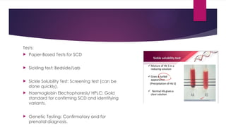 Sickle cell disease; Dr Dibyajyoti Prusty.pptx
