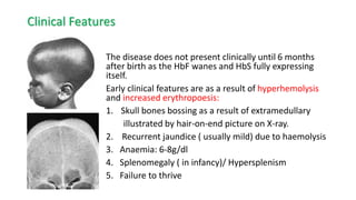 Topic: SICKLE CELL DISEASE IN CHILDREN-3.pdf