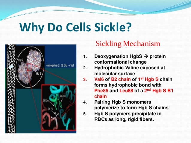 Sickle Cell Anemia Facts For Kids Sickle Cell Anemia Facts For Kids