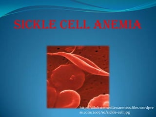 Sickle Cell Anemia http://adultstemcellawareness.files.wordpress.com/2007/10/sickle-cell.jpg 