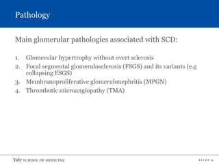 S L I D E 19
Pathology
Main glomerular pathologies associated with SCD:
1. Glomerular hypertrophy without overt sclerosis
2. Focal segmental glomerulosclerosis (FSGS) and its variants (e.g
collapsing FSGS)
3. Membranoproliferative glomerulonephritis (MPGN)
4. Thrombotic microangiopathy (TMA)
 