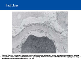 S L I D E 22
Pathology
 