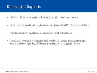 S L I D E 27
Differential Diagnosis
• Acute tubular necrosis <- hemodynamic insults or toxins
• Membranoproliferative glomerulonephritis (MPGN) <- hepatitis C
• Obstruction <- papillary necrosis or nephrolithiasis
• Papillary necrosis <- interstitial nephritis, acute pyelonephritis,
obstructive uropathy, diabetes mellitus, or analgesic abuse
 