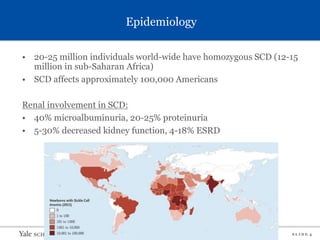 S L I D E 4
Epidemiology
• 20-25 million individuals world-wide have homozygous SCD (12-15
million in sub-Saharan Africa)
• SCD affects approximately 100,000 Americans
Renal involvement in SCD:
• 40% microalbuminuria, 20-25% proteinuria
• 5-30% decreased kidney function, 4-18% ESRD
 