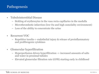 S L I D E 6
Pathogenesis
• Tubulointerstitial Disease
– Sickling of erythrocytes in the vasa recta capillaries in the medulla
– Microthrombotic infarction (low O2 and high osmolality environment)
– Loss of the ability to concentrate the urine
• Recurrent VOC
– Repetitive insults-> endothelial injury & release of proinflammatory
and profibrogenic cytokines
• Glomerular hyperfiltration
– Hyperperfusion driven hyperfiltration -> increased amounts of salts
and water in proximal tubules
– Elevated glomerular filtration rate (GFR) starting early in childhood
 